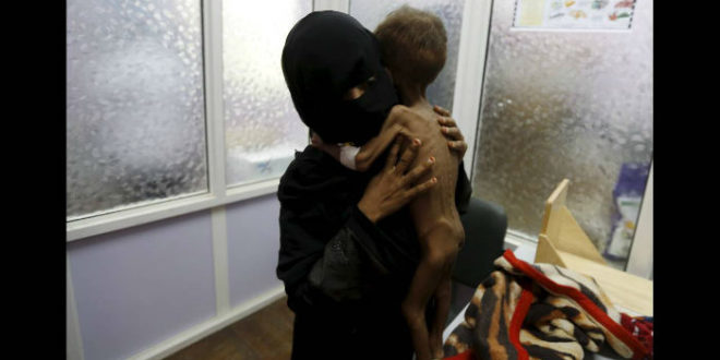 Στην Υεμένη κάθε μέρα σκοτώνται παιδιά.