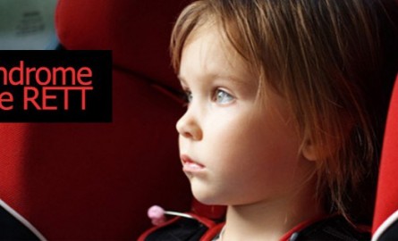 Σύνδρομο Rett: Γενετική νευρολογική διαταραχή που εμφανίζεται μόνο σε κορίτσια